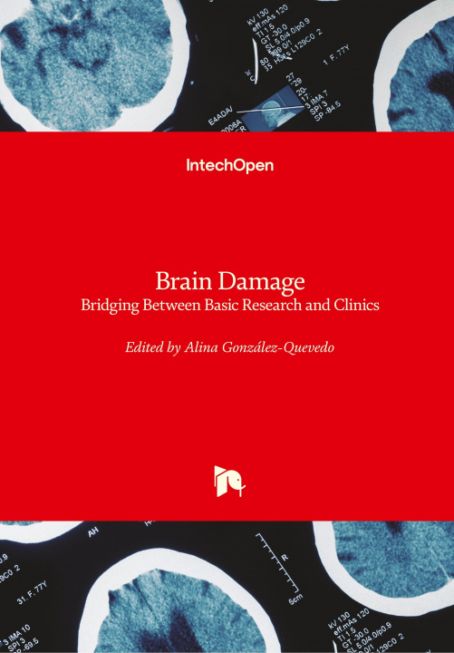 Knjiga Brain Damage Alina Gonzalez-Quevedo