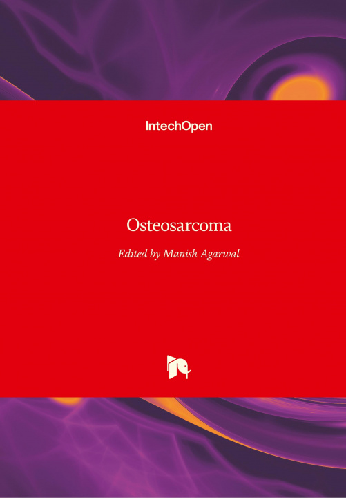 Knjiga Osteosarcoma Manish Agarwal