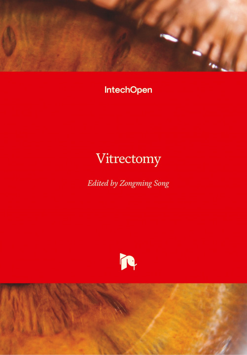 Knjiga Vitrectomy Zongming Song