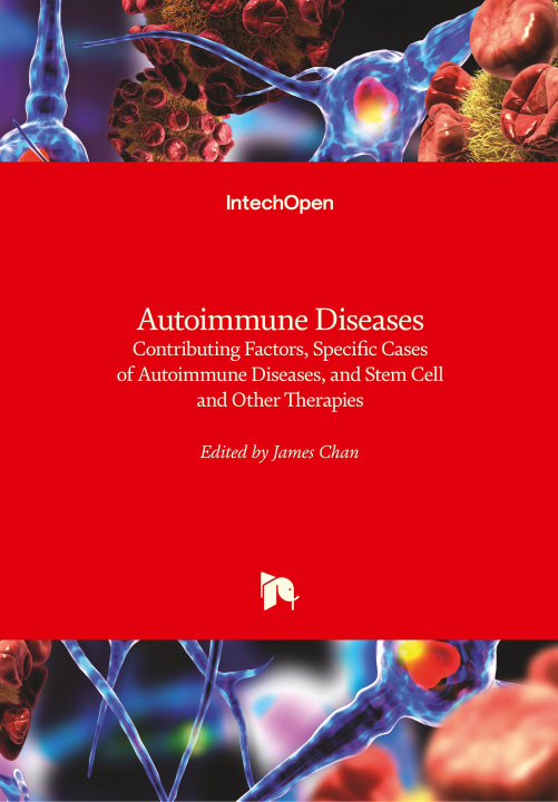 Kniha Autoimmune Diseases James Chan