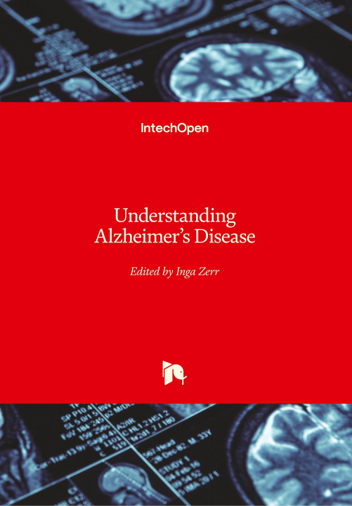 Boek Understanding Alzheimer's Disease Inga Zerr