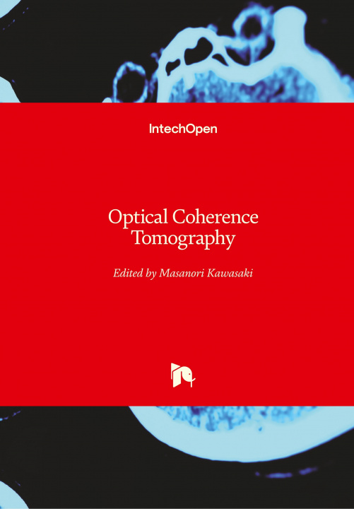 Knjiga Optical Coherence Tomography Masanori Kawasaki