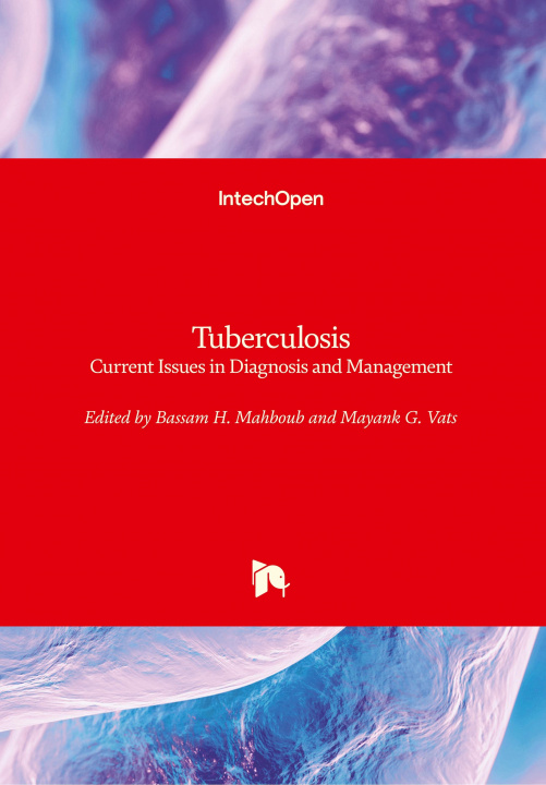 Knjiga Tuberculosis Bassam Mahboub