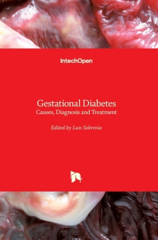 Libro Gestational Diabetes Luis Sobrevia