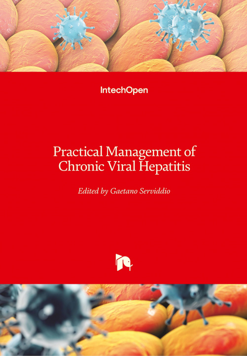 Kniha Practical Management of Chronic Viral Hepatitis Gaetano Serviddio