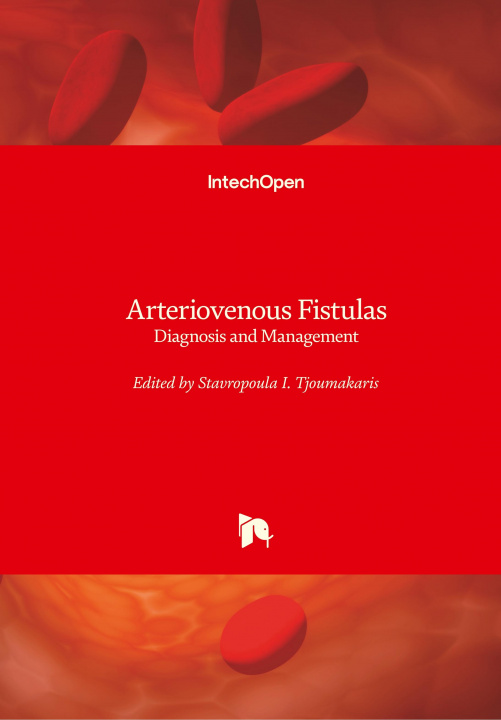 Carte Arteriovenous Fistulas Stavropoula Tjoumakaris