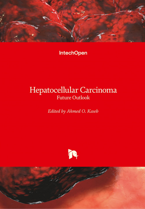 Carte Hepatocellular Carcinoma Ahmed Kaseb