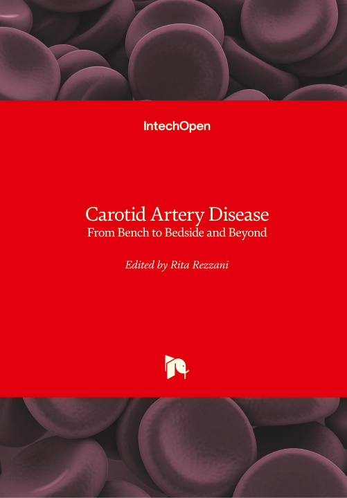 Boek Carotid Artery Disease Rita Rezzani