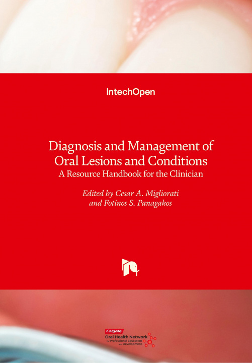 Kniha Diagnosis and Management of Oral Lesions and Conditions Cesare Migliorati