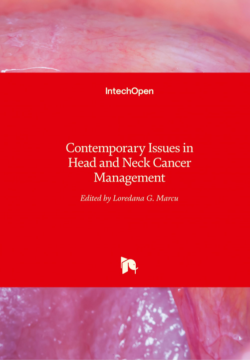 Książka Contemporary Issues in Head and Neck Cancer Management Loredana Marcu