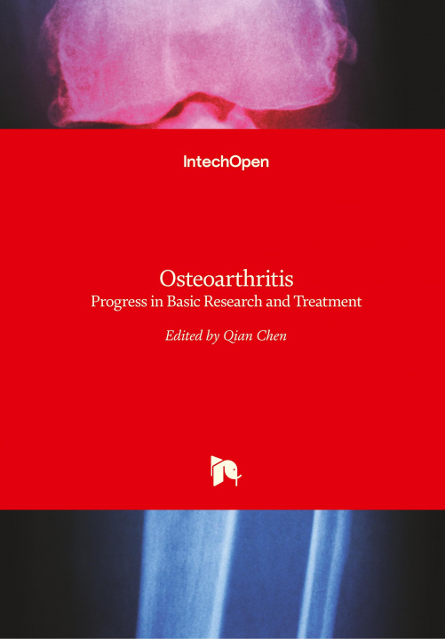 Buch Osteoarthritis Qian Chen