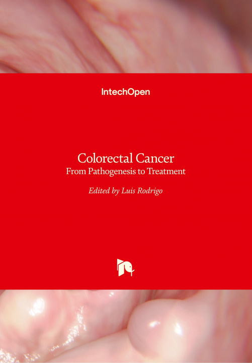 Kniha Colorectal Cancer Luis Rodrigo