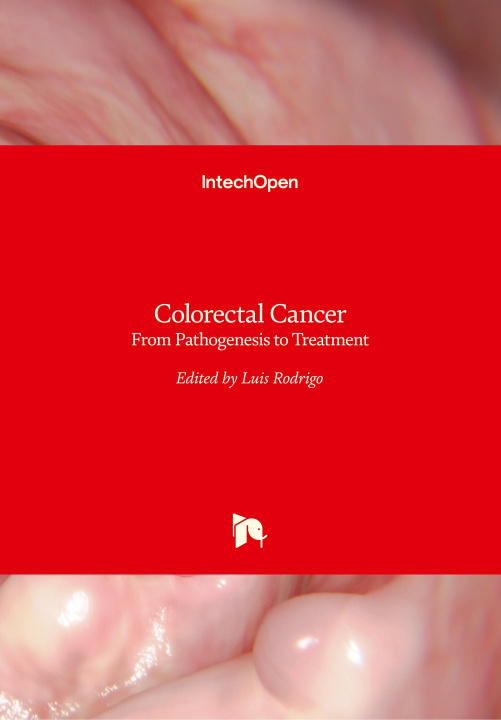 Buch Colorectal Cancer Luis Rodrigo