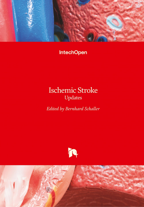 Kniha Ischemic Stroke Bernhard Schaller