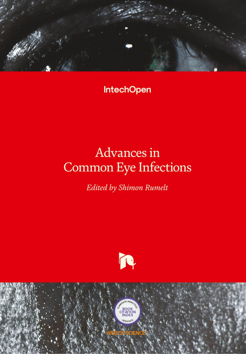 Książka Advances in Common Eye Infections Shimon Rumelt