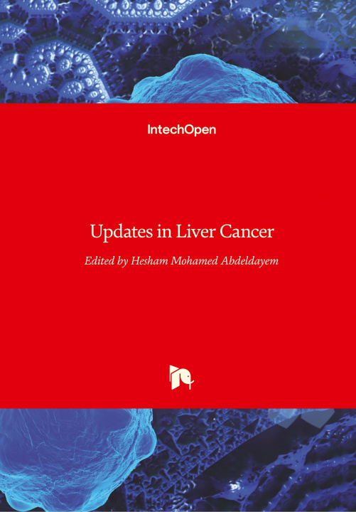 Kniha Updates in Liver Cancer Hesham Abdeldayem