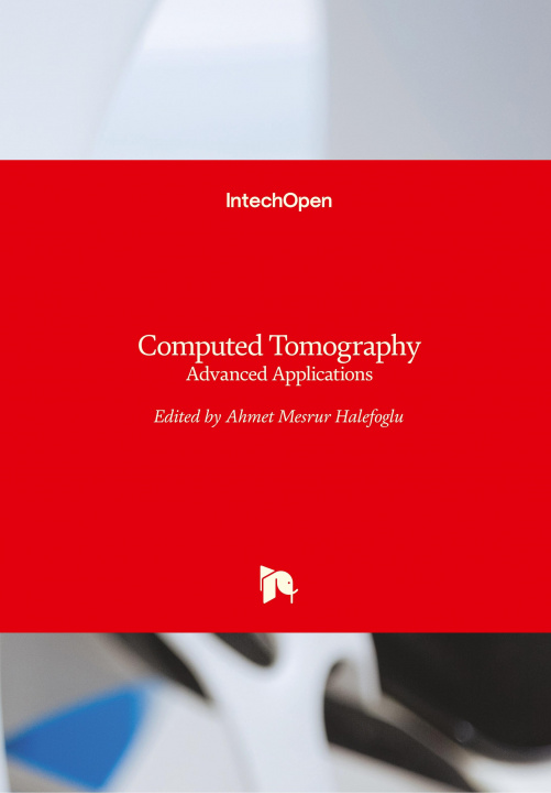 Book Computed Tomography Ahmet Mesrur Halefoglu