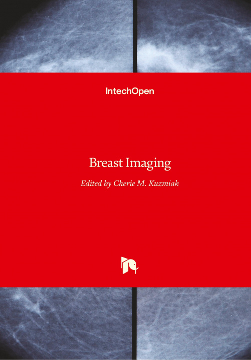 Knjiga Breast Imaging Cherie M. Kuzmiak