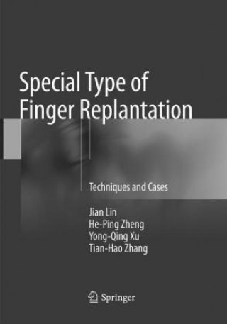 Kniha Special Type of Finger Replantation Jian Lin