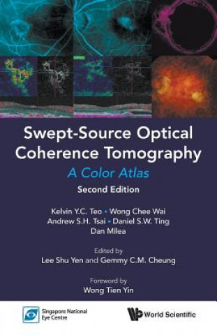 Книга Swept-source Optical Coherence Tomography: A Color Atlas Kelvin Y C Teo
