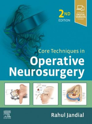 Книга Core Techniques in Operative Neurosurgery Mccormic