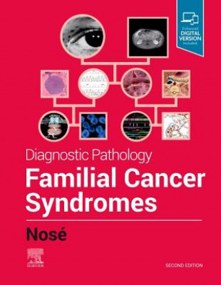 Book Diagnostic Pathology: Familial Cancer Syndromes Nose