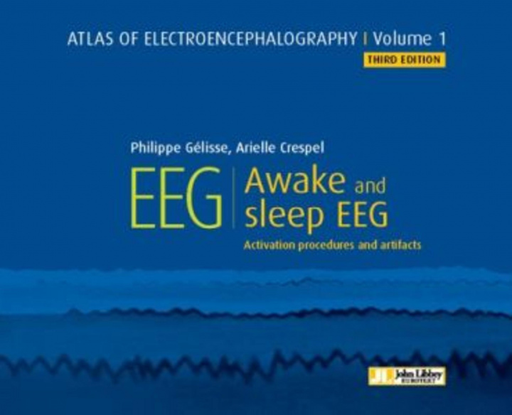 Carte Atlas of Electroencephalography -- Volume 1 Dr Philippe Gelisse