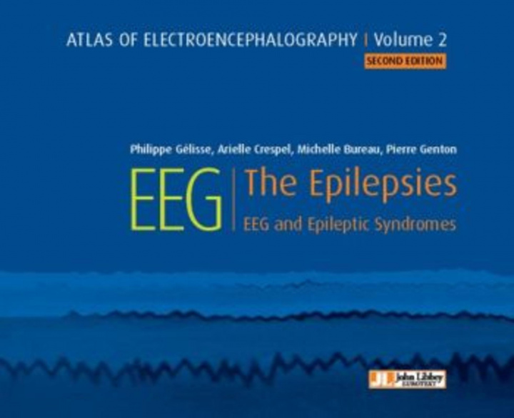Carte Atlas of Electroencephalography -- Volume 2 Dr Philippe Gelisse