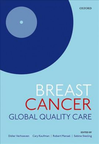 Könyv Breast cancer: Global quality care Cary S. Kaufman