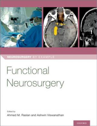 Книга Functional Neurosurgery 