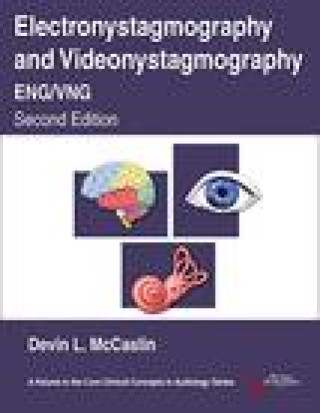 Book Electronystagmography/Videonystagmography (ENG/VNG) Devin L. McCaslin