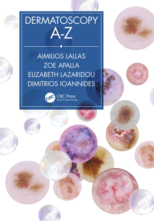 Książka Dermatoscopy A-Z Aimilios Lallas