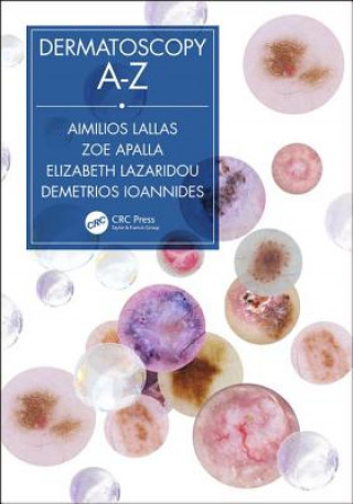 Könyv Dermatoscopy A-Z Aimilios Lallas