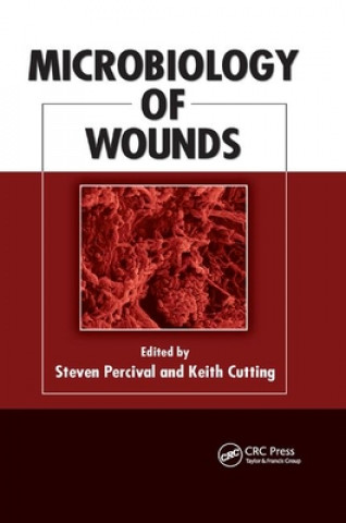 Carte Microbiology of Wounds 