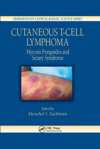 Kniha Cutaneous T-Cell Lymphoma Herschel S. Zackheim