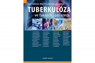 Kniha Tuberkulóza ve faktech i obrazech Ivan Solovič