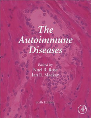 Książka Autoimmune Diseases 