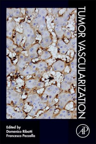Carte Tumor Vascularization Domenico Ribatti