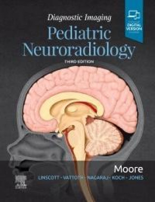 Kniha Diagnostic Imaging: Pediatric Neuroradiology Kevin R. Moore