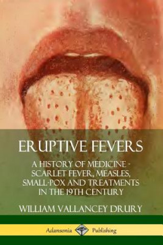 Kniha Eruptive Fevers: A History of Medicine - Scarlet Fever, Measles, Small-Pox and Treatments in the 19th Century William Vallancey Drury