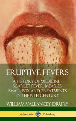 Kniha Eruptive Fevers: A History of Medicine - Scarlet Fever, Measles, Small-Pox and Treatments in the 19th Century (Hardcover) William Vallancey Drury