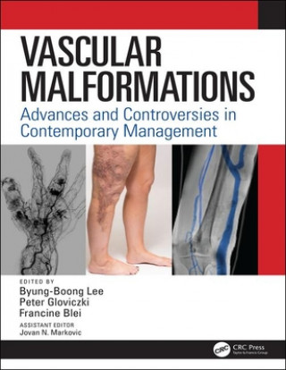 Könyv Vascular Malformations 