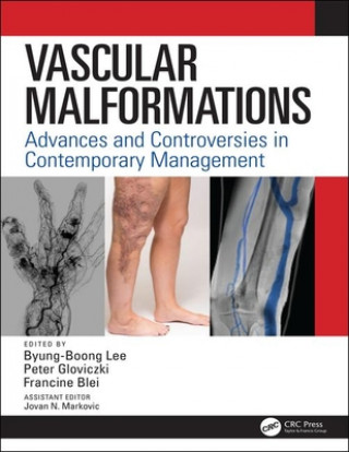 Kniha Vascular Malformations 