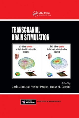 Carte Transcranial Brain Stimulation 