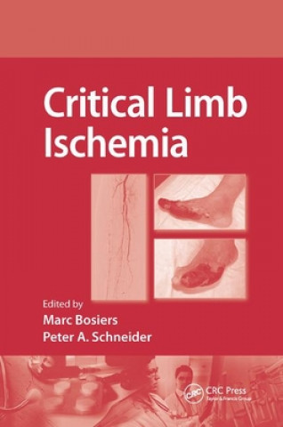 Carte Critical Limb Ischemia 
