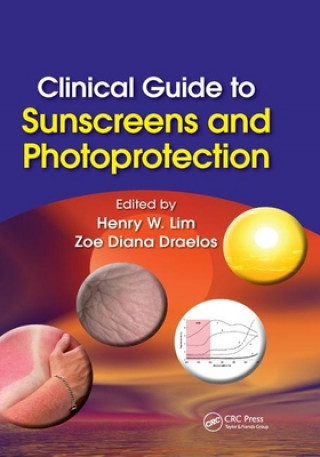 Książka Clinical Guide to Sunscreens and Photoprotection 