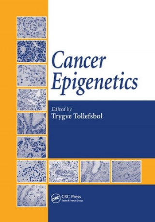 Βιβλίο Cancer Epigenetics 