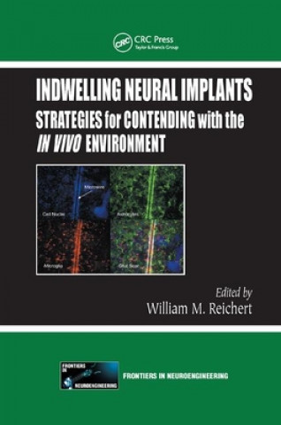 Buch Indwelling Neural Implants 