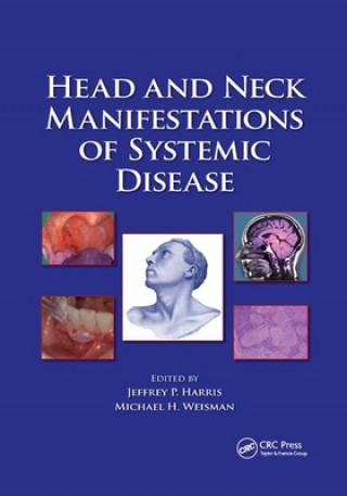 Kniha Head and Neck Manifestations of Systemic Disease 