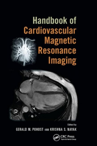Könyv Handbook of Cardiovascular Magnetic Resonance Imaging 